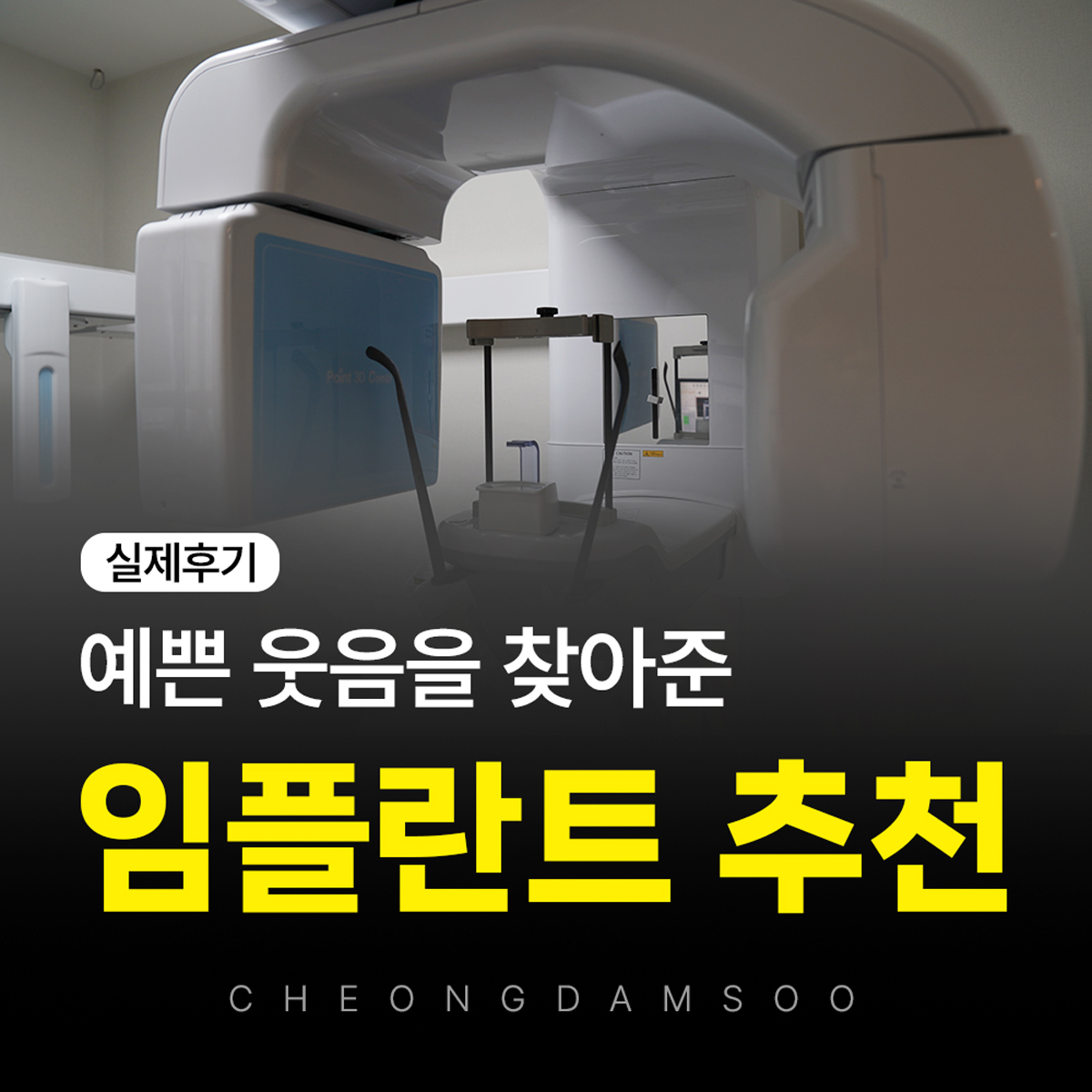 대전치과 임플란트 추천